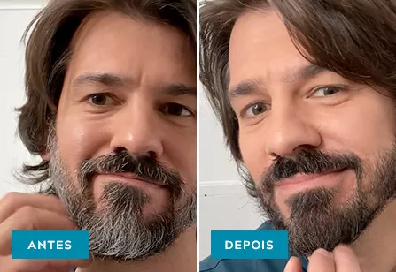 Bigode e barba