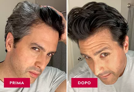 Before & After image