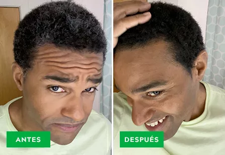 Before & After image