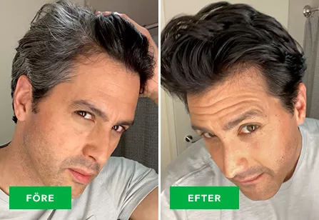 Before & After image