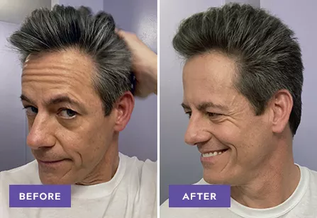 Touch Of Gray results: before and after