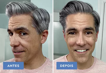 Touch Of Gray results: before and after