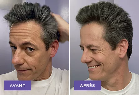 Touch Of Gray results: before and after