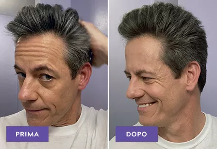 Effetto Brizzolato results: before and after