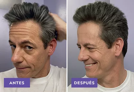 Touch Of Gray results: before and after